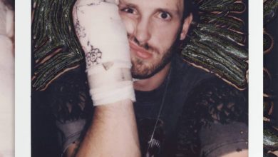 Logan Paul with a broken hand